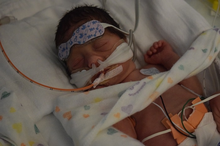 baby Petra is held by her parents after her premature birth 04